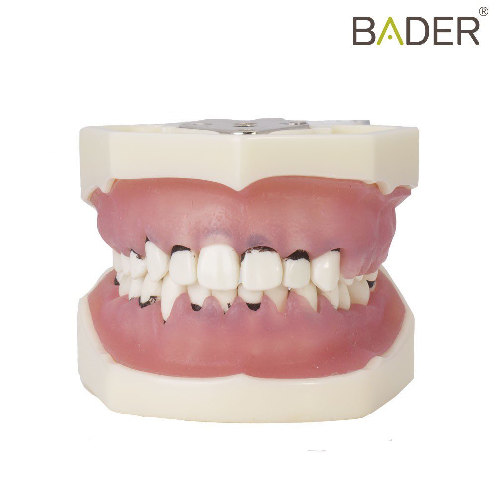 TIPODONTO DE PERIODONCIA CON ARTICULADOR