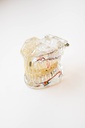 MODELO DENTAL DE IMPLANTE CON NERVIO