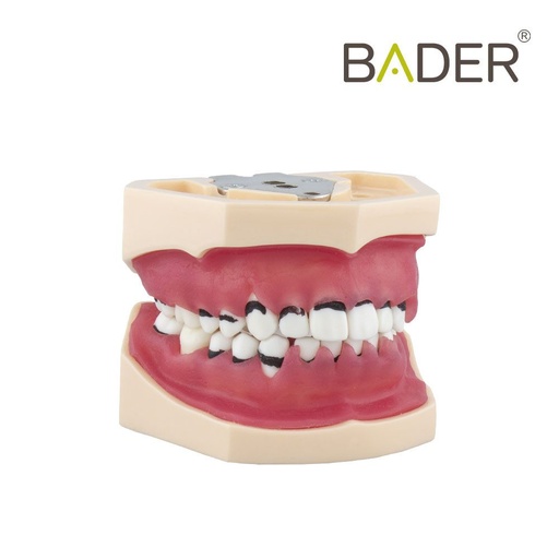 [0905113] MODELO DE PERIODONCIA COMPLETO