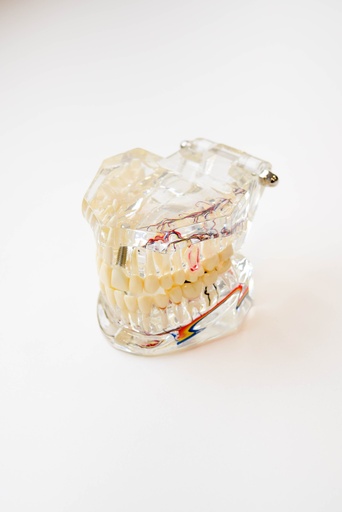 [0905111] MODELO DENTAL DE IMPLANTE CON NERVIO